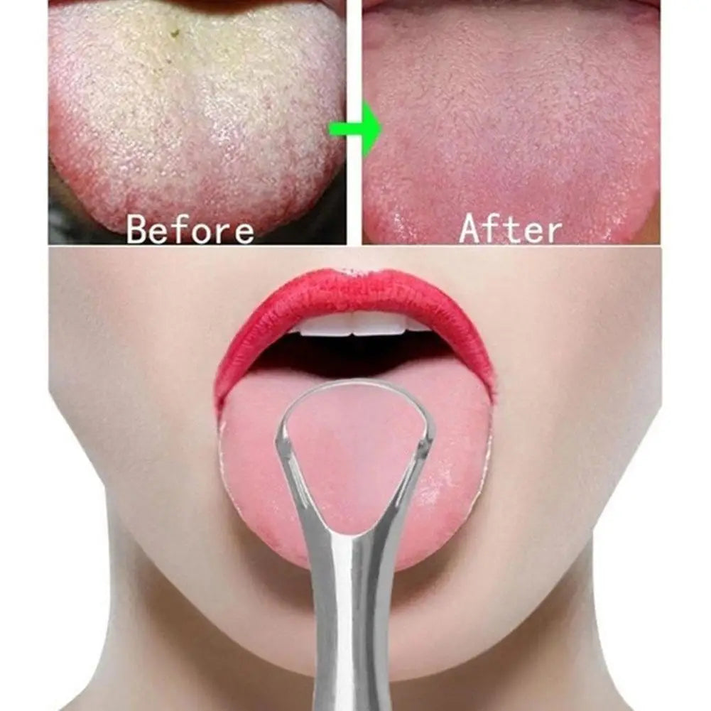 Everyday Care Stainless Steel Tongue Scraper