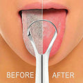 Everyday Care Stainless Steel Tongue Scraper